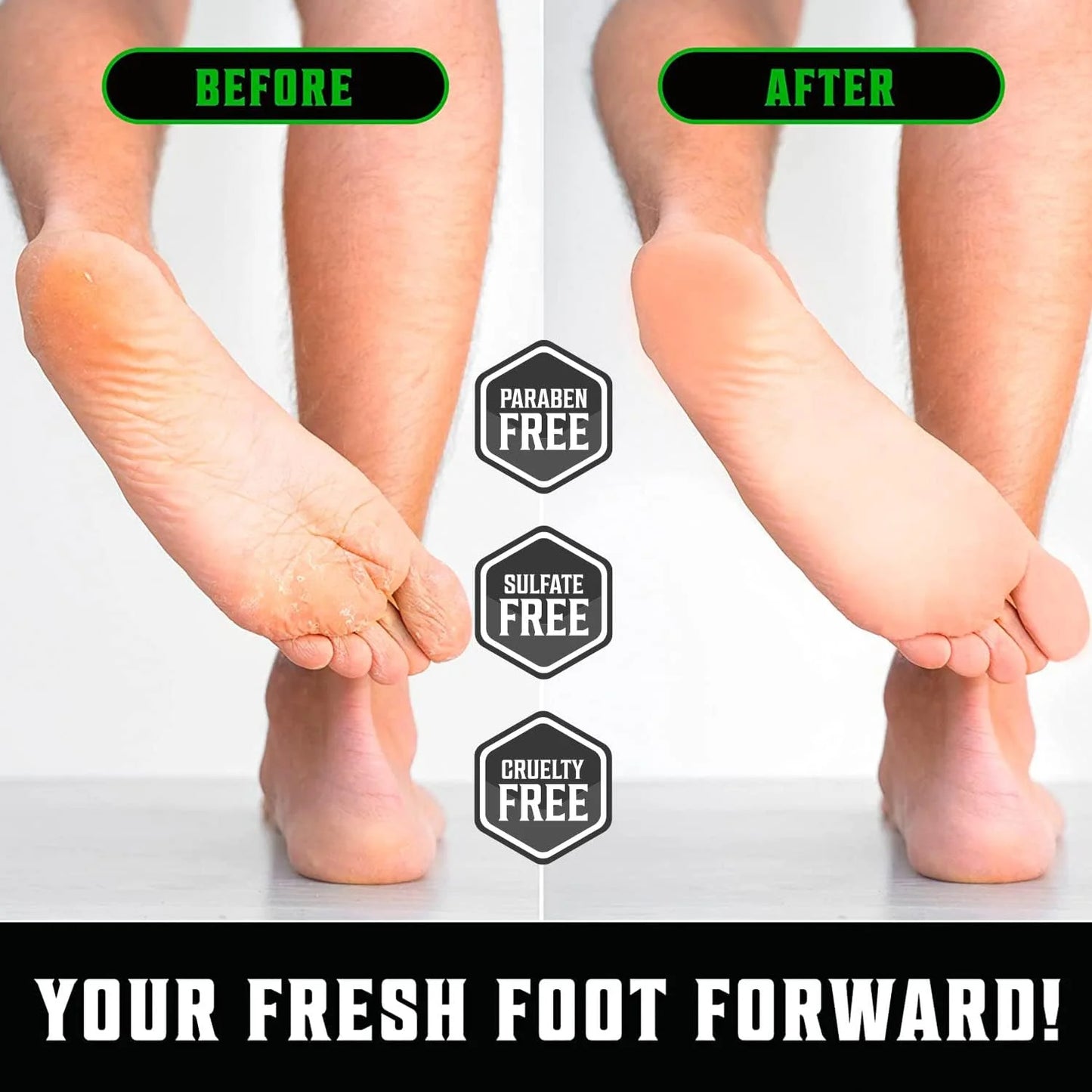 - Tea Tree Foot Cream for Dry Cracked Feet - Foot Cream & Balm W/ Aloe Vera & Mint - Minty Scent, 8 Oz
